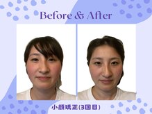 プログレスボディールーム(Progress Body Room)の雰囲気（新たな常識を作り、新たな体を造る【姿勢/小顔】）