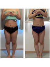 ヨサパーク フラネ(YOSA PARK Flaner)/