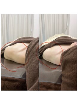 晴(haru)/半オーダーメイド肩がっつり！