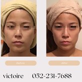 ヴィクトワール(Victoire)