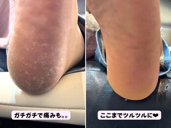 ココネイル(coco.nail)/