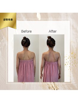 ロココ 町田店(Rococo)/首やアンダーラインがスッキリ!