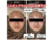 最新韓国肌管理＆韓国コルギ・カッサが受けられます♪【コルギ】