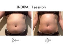 レア(Le'a)の雰囲気（万能美容機器インディバでお悩み解決＊定期ケアで生まれ変わる体）