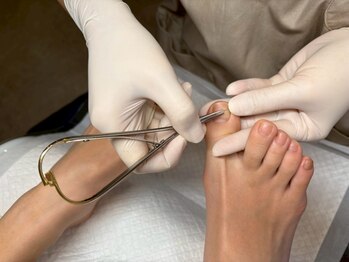 ドクターネイル爪革命　岐阜店｜足の爪切り・巻き爪・魚の目・角質・肥厚爪の足専門店の写真/巻き爪矯正は痛いというイメージを覆す、やさしい巻き爪補正◎トラブル爪の専門家が最適施術をご提案！