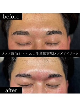 ユー 千葉駅前店(you)/ビフォ－アフター写真