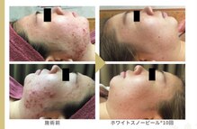 ジョン ハンプトン