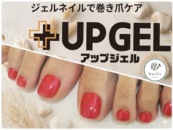 【巻き爪ケア】UP GEL カラー