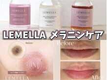 ジュエリーボディー(Jewelry body)の雰囲気（【韓国発黒ずみケア】基本的に１回の施術で効果を実感頂けます！）