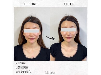 リベルタ鍼灸整骨院 なんば店(Liberta鍼灸整骨院)の写真