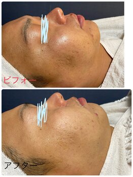 メディカルエステ ユウ(Yuu)/男性のお客様も多いです