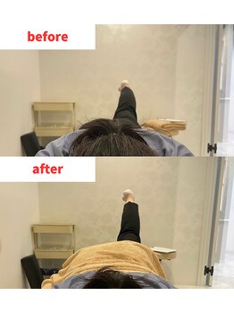 ナオル整体 福岡香椎院(NAORU整体)/40代女性施術事例【股関節】