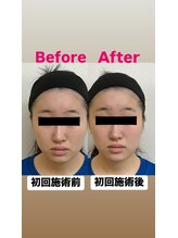 ゆうはり鍼灸整骨院 恵比寿/お客様Before　After