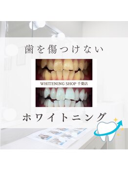ホワイトニングショップ 千葉店/歯科提携　ホワイトニング専門店