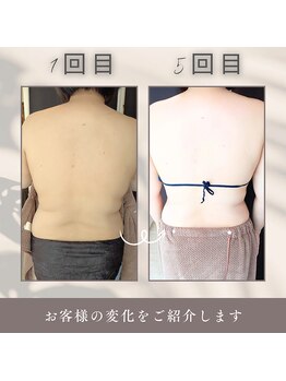 エバンス ノット(Evans knot)/【背中二の腕引き締めコース】