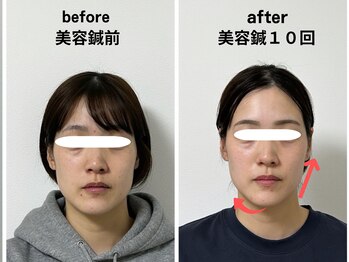 サロンスマイル