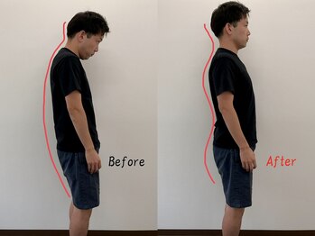 シームル/猫背矯正/姿勢改善/ボディケア