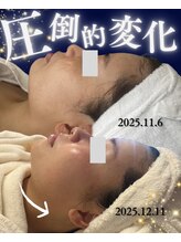 リヴィア(LIVIA)/ハンドトリートメントだけの変化