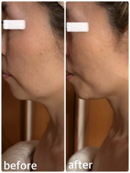 ジフィー(Gify)/ぽにょ撃退!