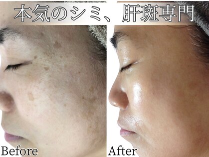 ルノン(LUNON)の写真