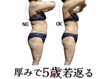 ビューティサロンツリー(TREE)の雰囲気（下着に乗っかるお肉…分厚い背中…服が似合わない…変わります♪）