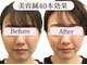 アネモネ 心斎橋院の写真