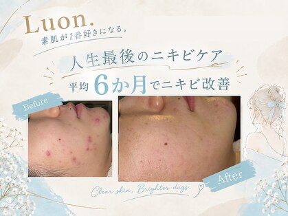 ルオン(Luon.)の写真