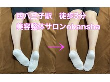 美容整体サロン オオカンシャ(okansha)/骨盤矯正BeforeAfter