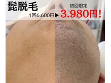 プライベートネイルサロン そねいるの雰囲気（痛みを抑えて効果は抜群！毎朝の面倒なヒゲ剃りから卒業！！）