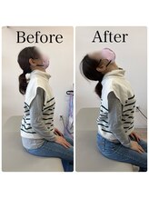 まこと整体院 新鳥栖店/ビフォーアフター（首、肩こり）