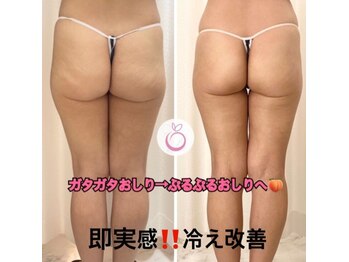 ハナスイ(HANASUI)/骨盤の歪みを整えてお尻もアップ