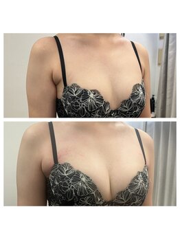 ジュエルリング(Jewel Ring)/バストアップ【恵比寿代官山】