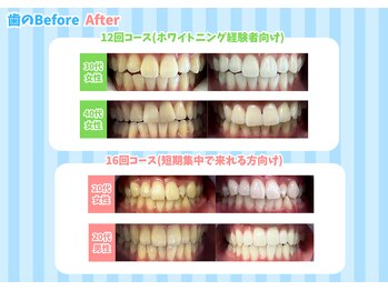 ドルチェ 水戸店(Dolce)/コース別☆Before After