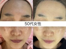 サクラ 本厚木駅前店(SAKURA)/40代後半　2回目継続中