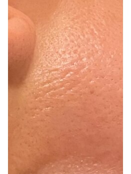 エステサロン ジジ 新宿(JIJI)/ハーバルメソッドのお客さま