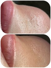 ミロク(MIROKU.)/フェイスワックストリートメント