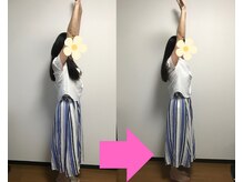 ヌフヌフ(neuf neuf)の雰囲気（肩こりの方、施術後肩が楽になり胸が開いてスーと腕が上がります）