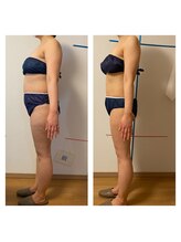 ヘルシースリムなにわ/リジュ・べネーション　10回