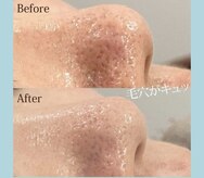 フォルチェ 神辺店(Folche)