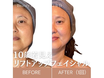 リコ 白金台(Liko)の写真