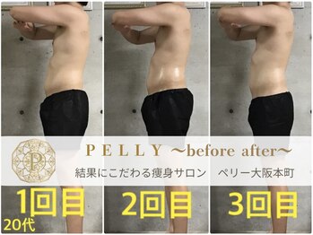 ペリー(PELLY)/男性30代　before after