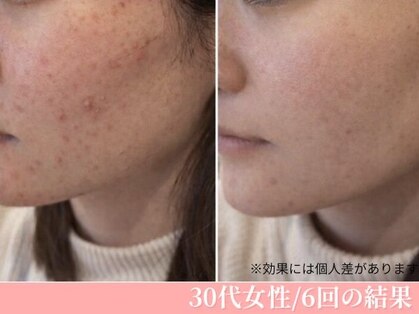 ルージュ(CP Rouge)の写真