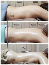 ソエルテ(Soelte)/サイズダウンへ導くリンパケア