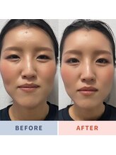 姿勢矯正院/リフトアップ♪