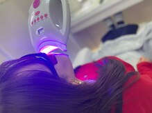 エクシアホワイトニング 明石店/ホワイトニング体験/記念写真