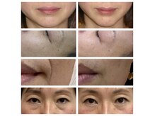 ナチュライズ(NatuRise)の雰囲気（小顔リフトアップ・毛穴・肌のハリツヤ美容鍼）