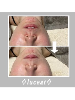 ルーチェット(luceat)/