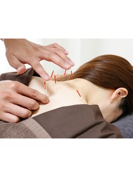 首・肩のつらさを改善したい