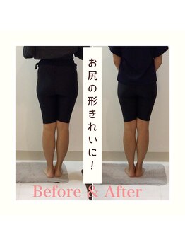 スタイルラボ高松/産後の骨盤矯正の効果♪