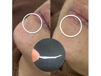 ヴィーナス(Venus)/